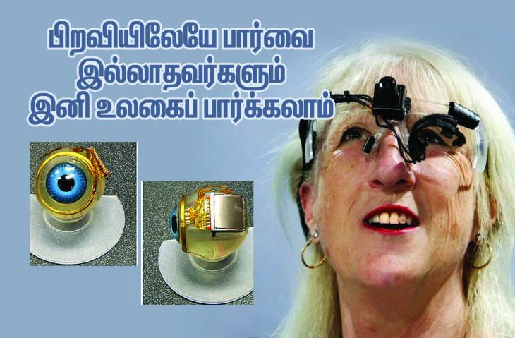 உலகில் இனி யாரும் பார்வையற்றோர் என்பதே இல்லை! 