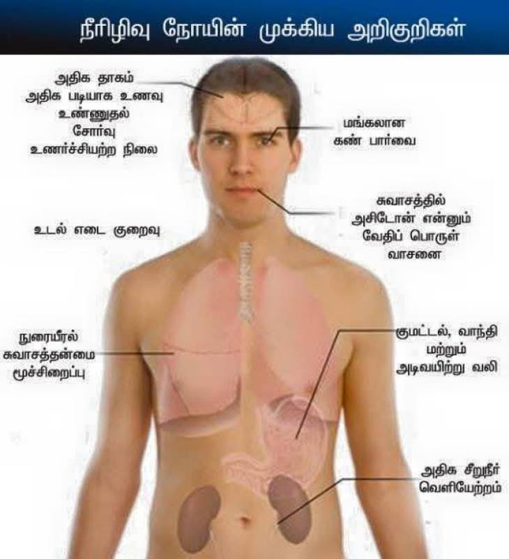 சர்வதேசப் பரவலாக மாறியுள்ள நீரழிவு நோய்க்கு அரிசிச்சோறுதான் காரணமா?